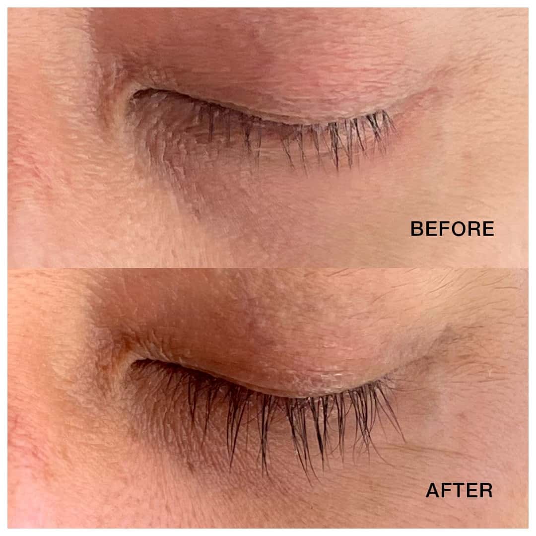 Lashes are beautifully lengthened, voluminous, and well-defined after using the lash serum.