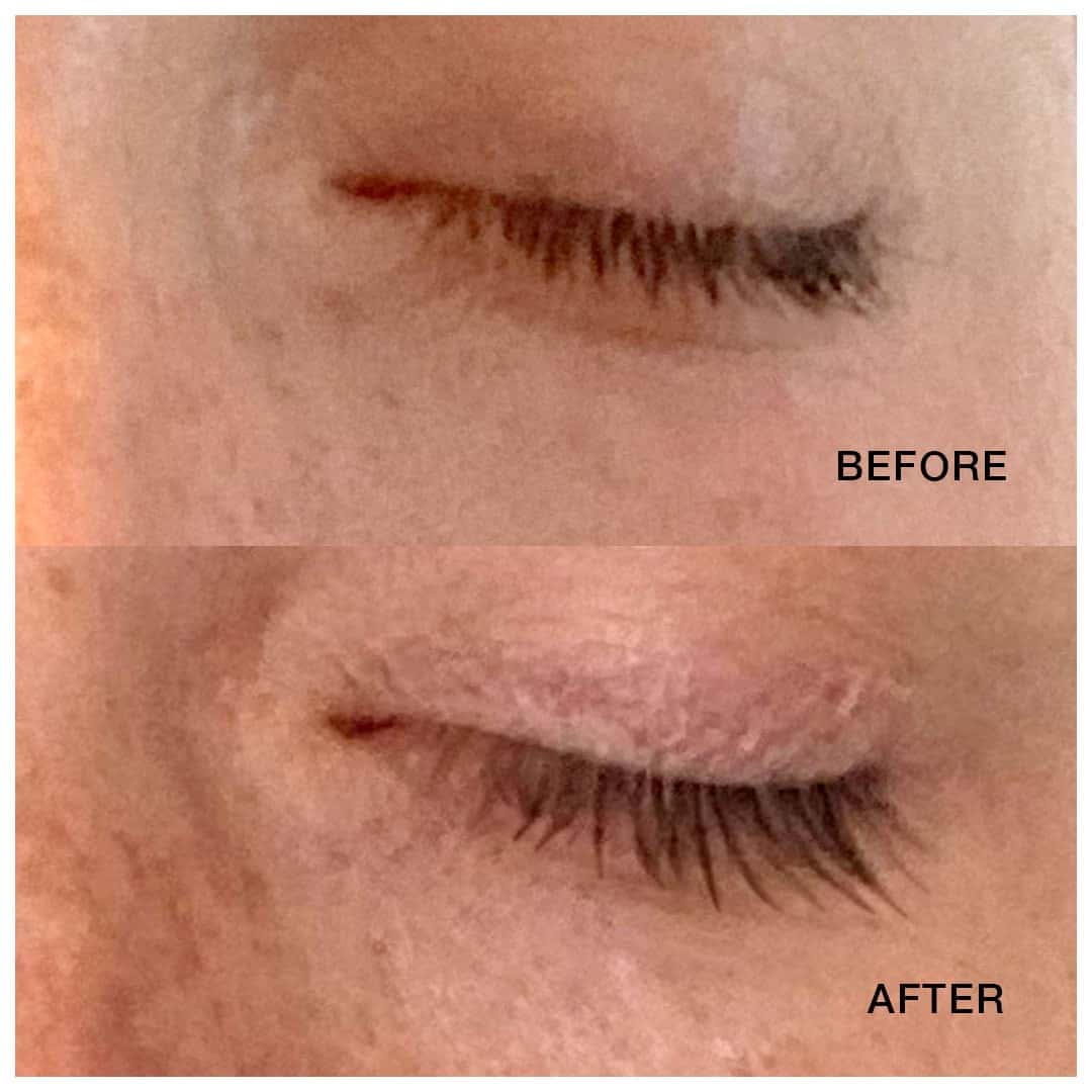 After six weeks of using lash serum, lashes have been beautifully enhanced, appearing longer, fuller, and incredibly defined.